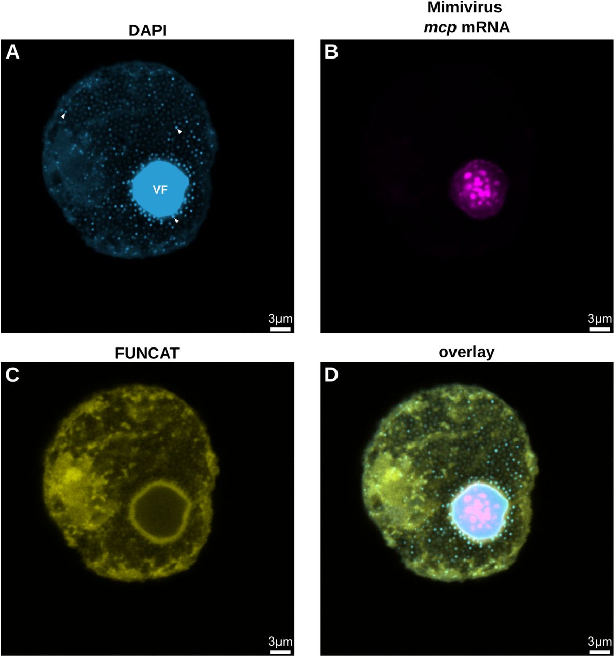 New work out! Visualizing transcription and translation in Mimivirus during an infection cycle